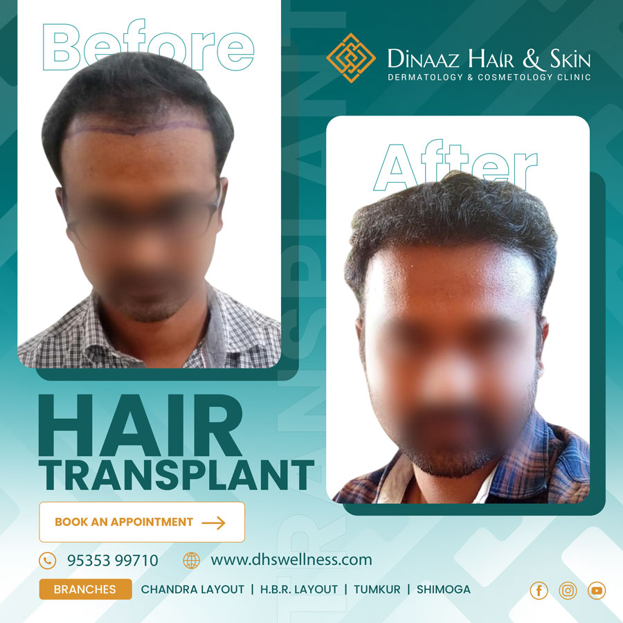 before-after-poster-12