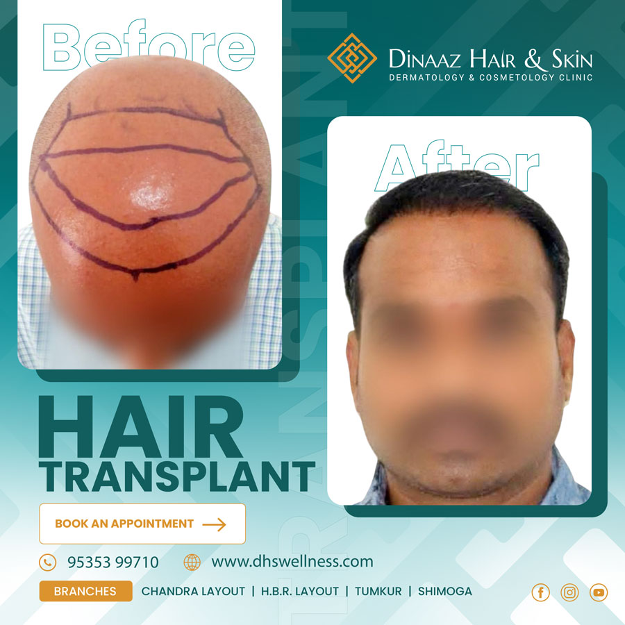 before-after-poster-16