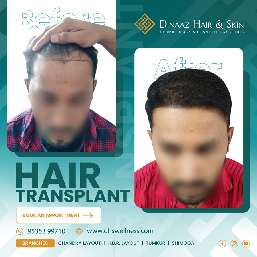 before-after-poster-17