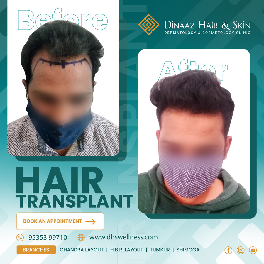before-after-poster-4