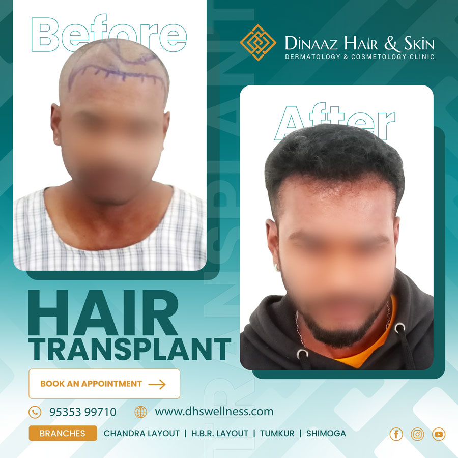 before-after-poster-7