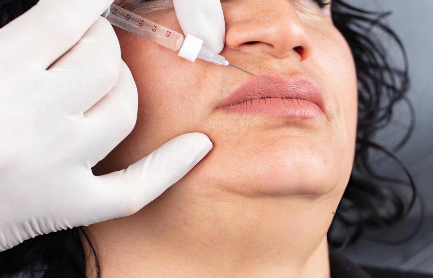 Woman with smooth, youthful skin after Botox and filler treatment at Dinaaz Hair & Skin Care Clinic