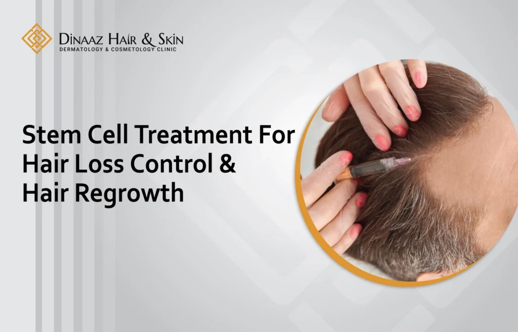 Stem cell treatment for hair loss showing hair regrowth process